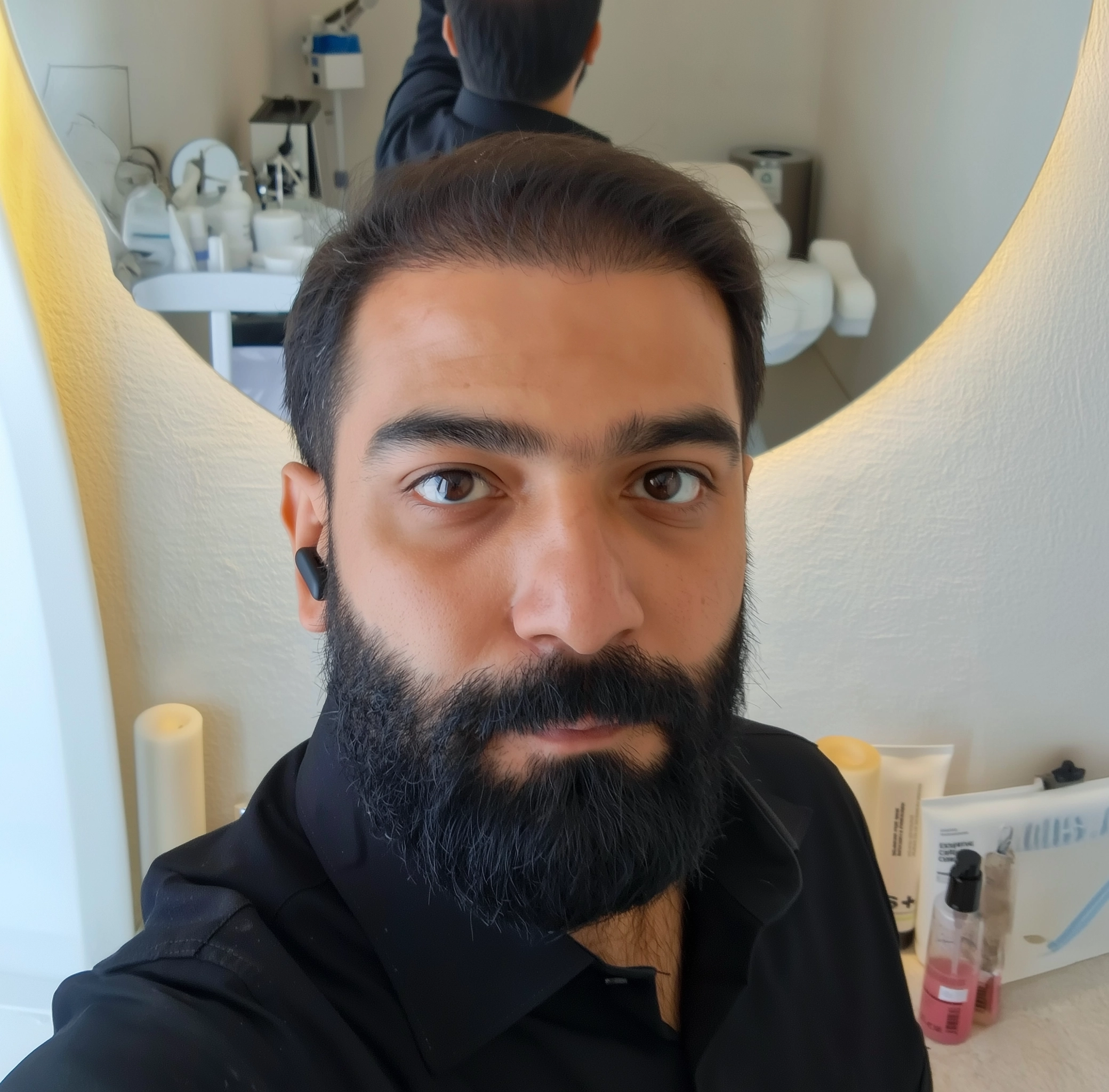 FUE Hair Transplant Procedure Benefits Cost FUE Hair Transplant Procedure Benefits Cost