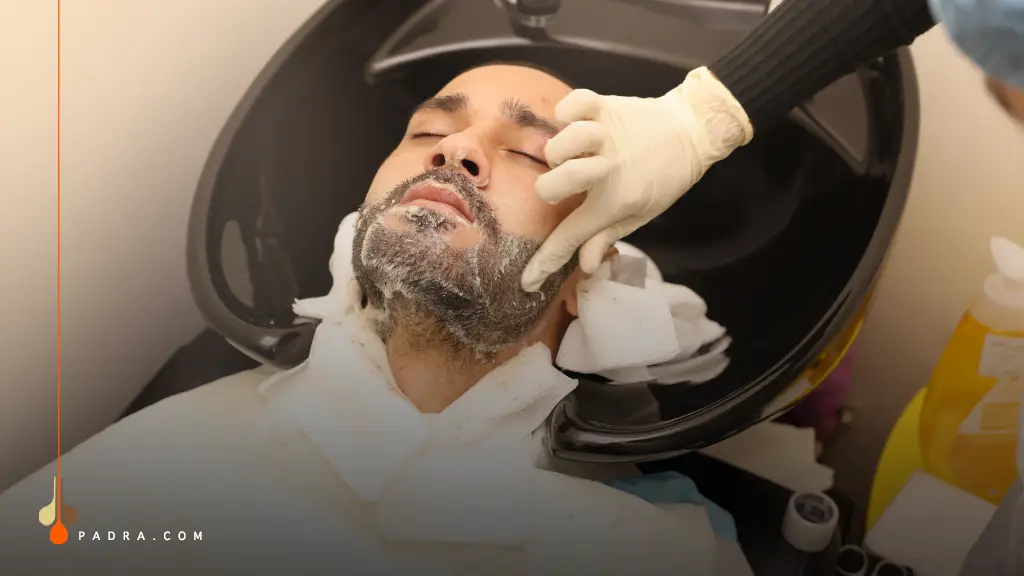 washing after Beard Transplant