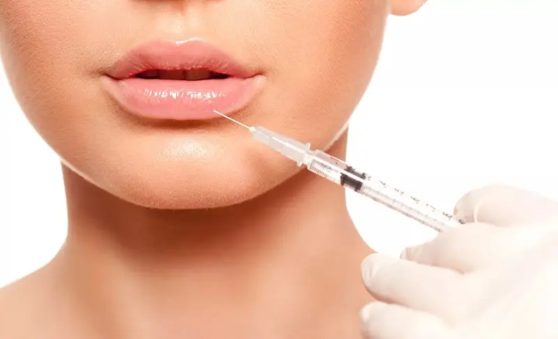 Botox vs. Fillers for Lips