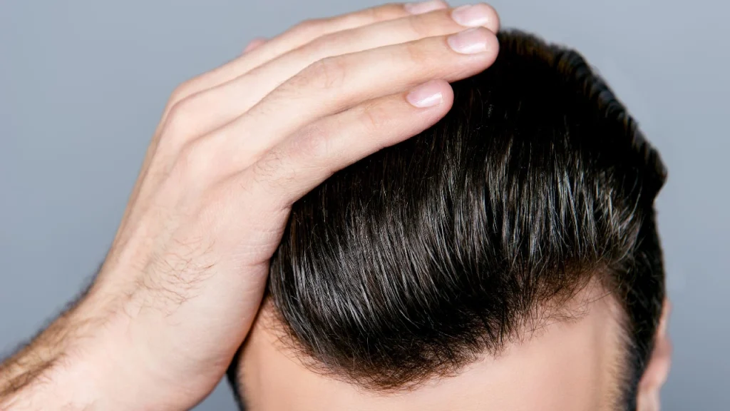 man with good hair after hair transplant
