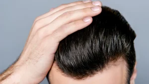 man with good hair after hair transplant