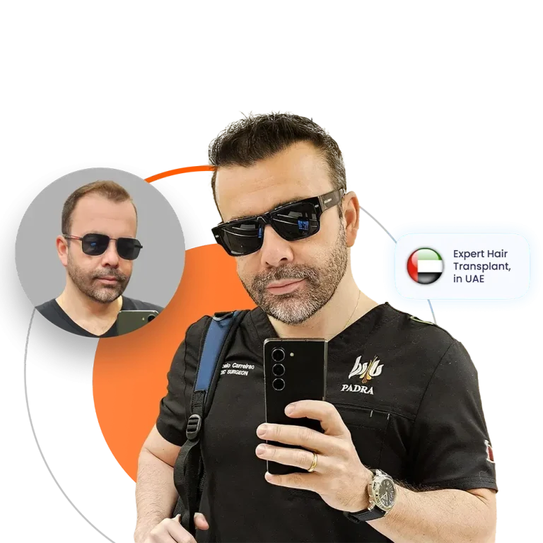 hair transplant in Dubai