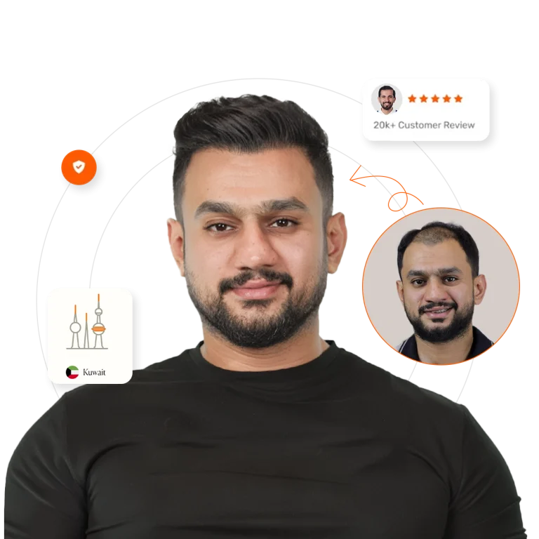 hair transplant in Kuwait