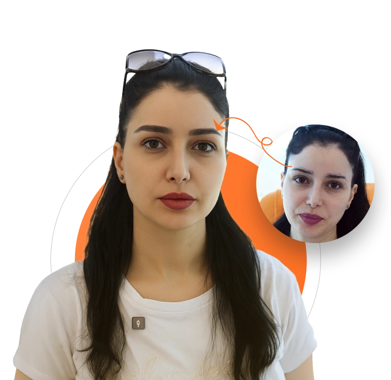 زراعة الحواجب في بادرا