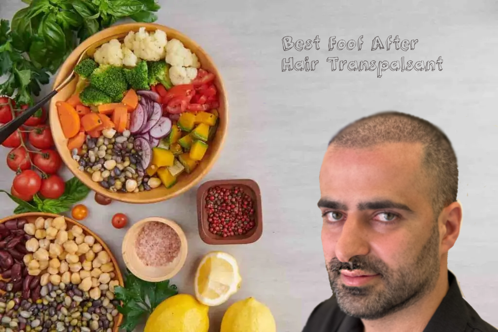 est food after hair transplantation