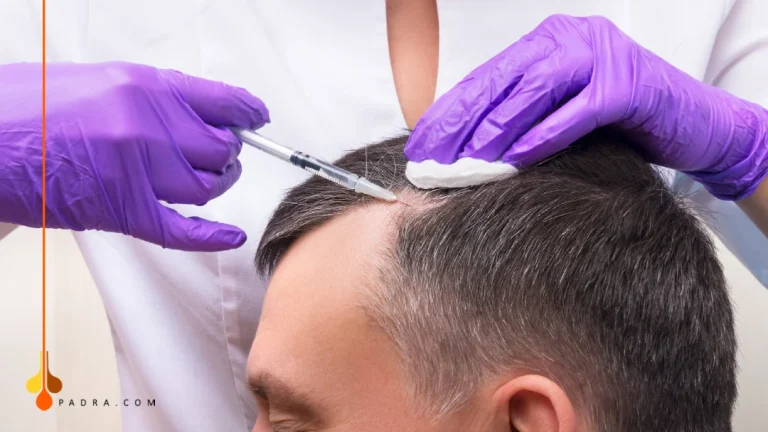 stem cell injection for hair transplant