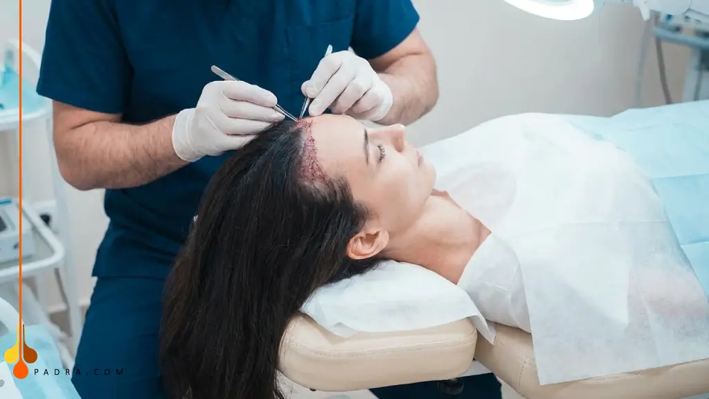 زراعة الشعر الطويل