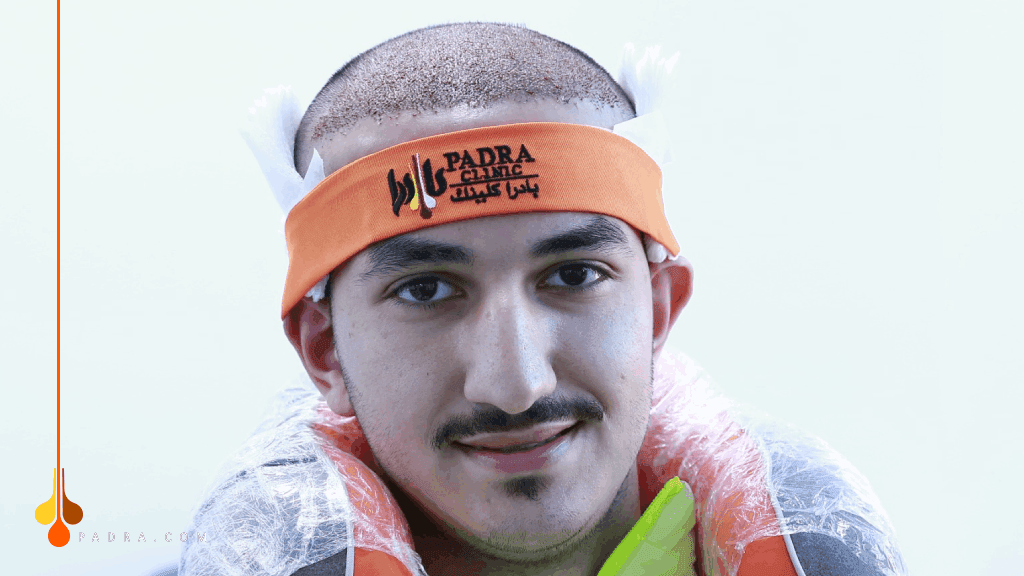 کیف یبدو الشعر المزروع يوم بعد الزراعة