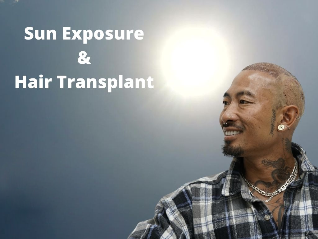 Sun Exposure After Hair Transplant