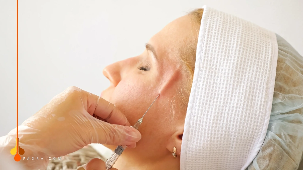 فيلر للصدغين