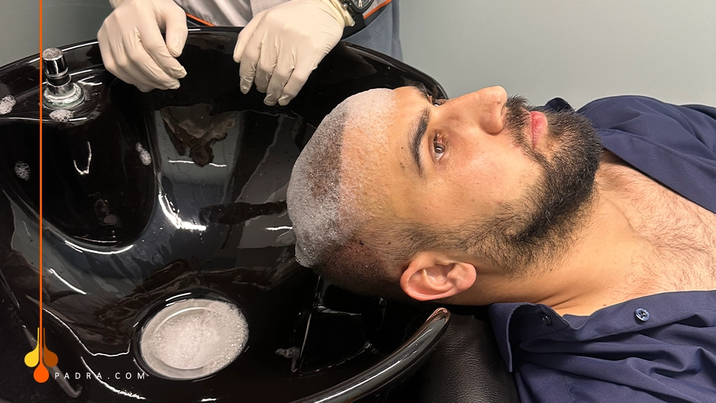 غسل الشعر بعد 10 أيام