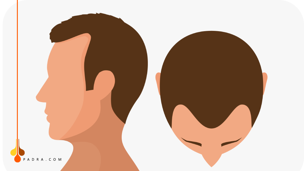 مرحلة الثانية للنوروود