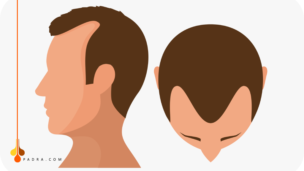 مرحلة الثالثة للنوروود