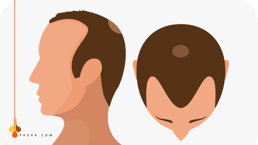 المرحلة الرابعة