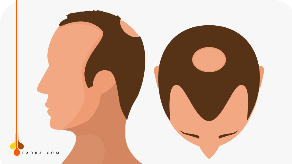 المرحلة الخامسة