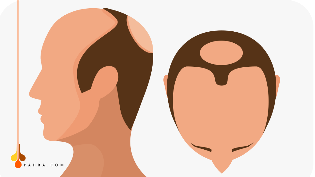 المرحلة السادسة