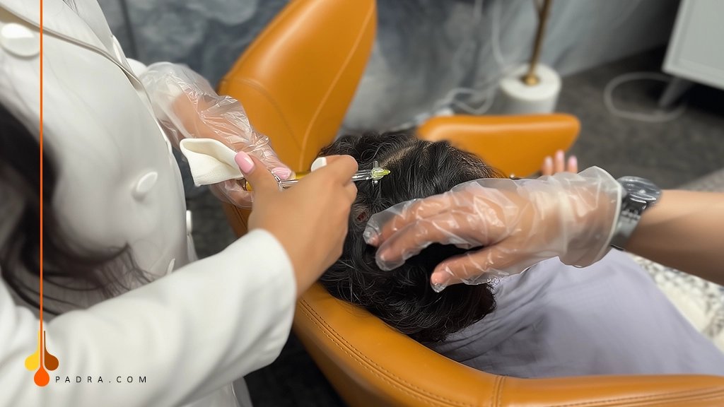 الفيلر للشعر 