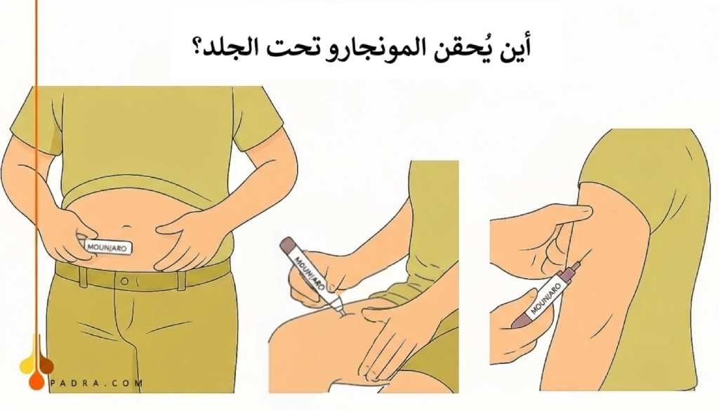 أين تحقن إبر مونجارو للتنحيف