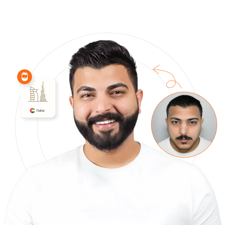Beard & Moustache Transplant in dubai