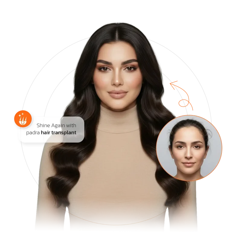 padra women's hair transplant