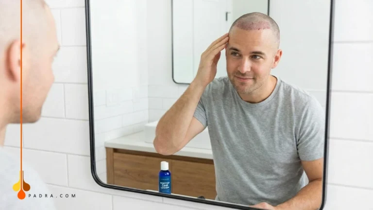 Hair Transplant Scabs