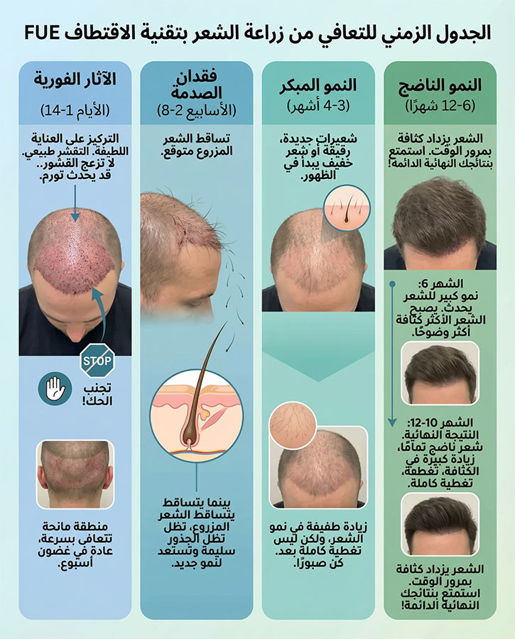 مرحلة التعافي بعد FUE