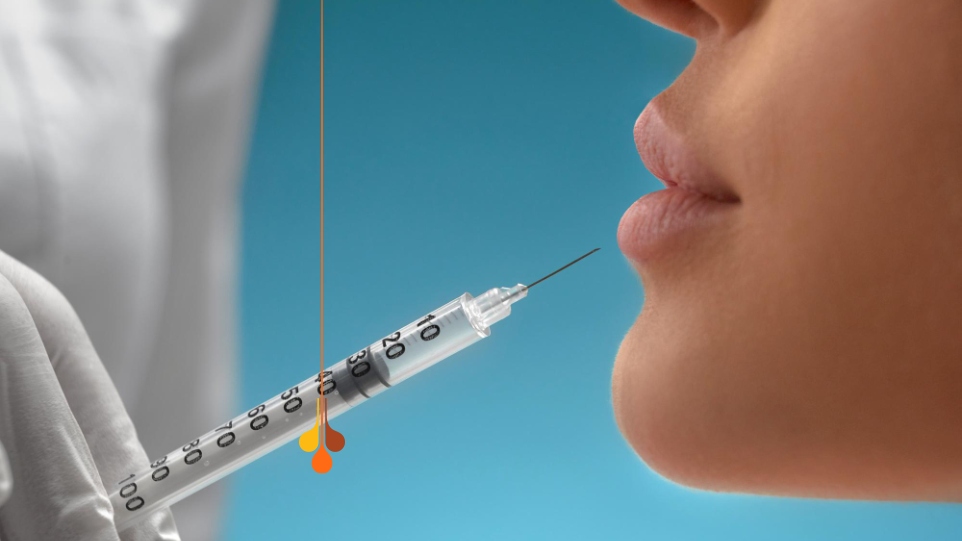 كيفية عمل فيلر الشفاه الروسي