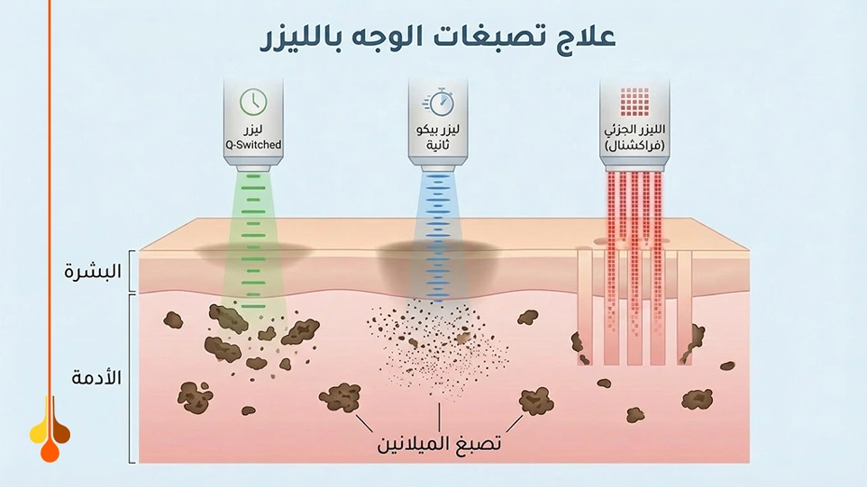 أنواع التصبغات الجلدية