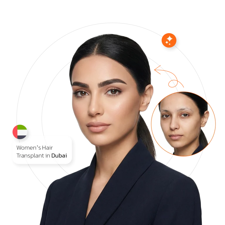eyebrow transplant in Dubai