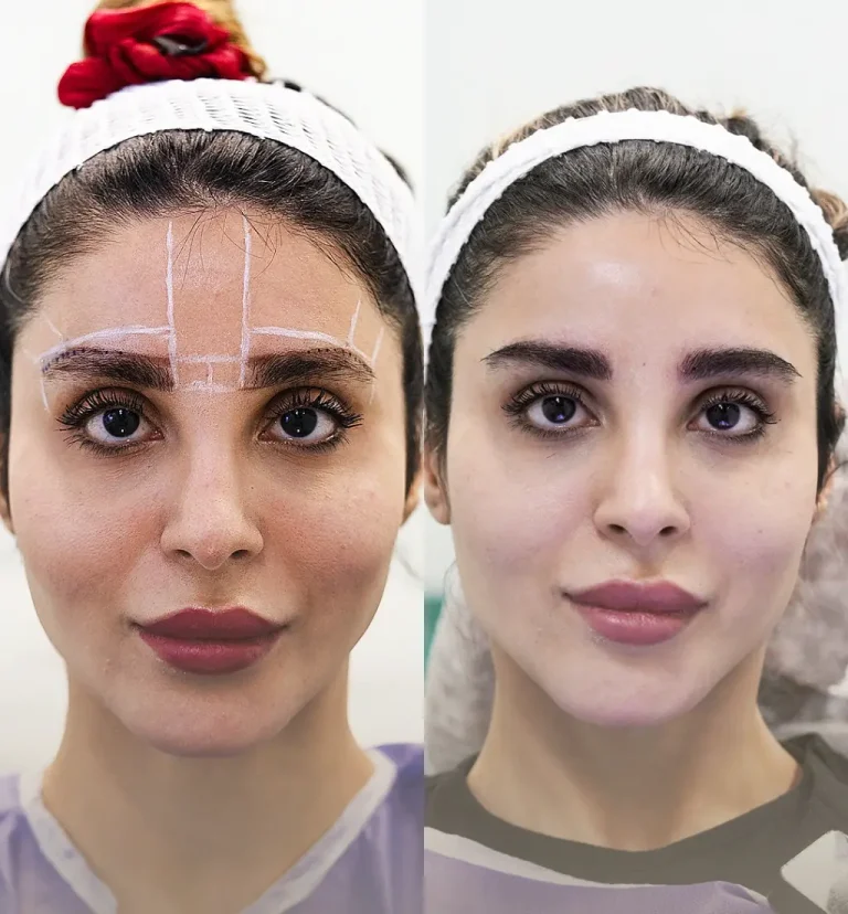 Introducing the NTF Method