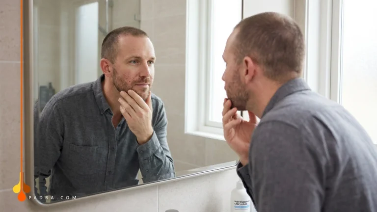 beard transplant after 1 week
