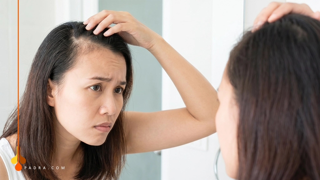 The Best Non-Surgical Treatments for Hair Loss