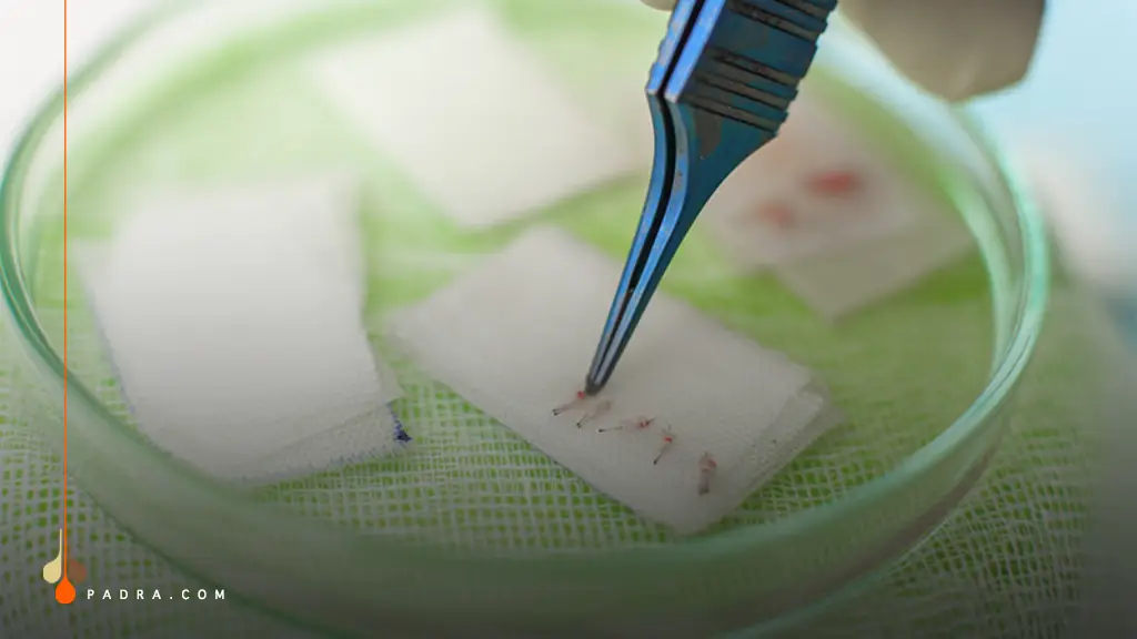How Does FUE Hair Transplant Work?