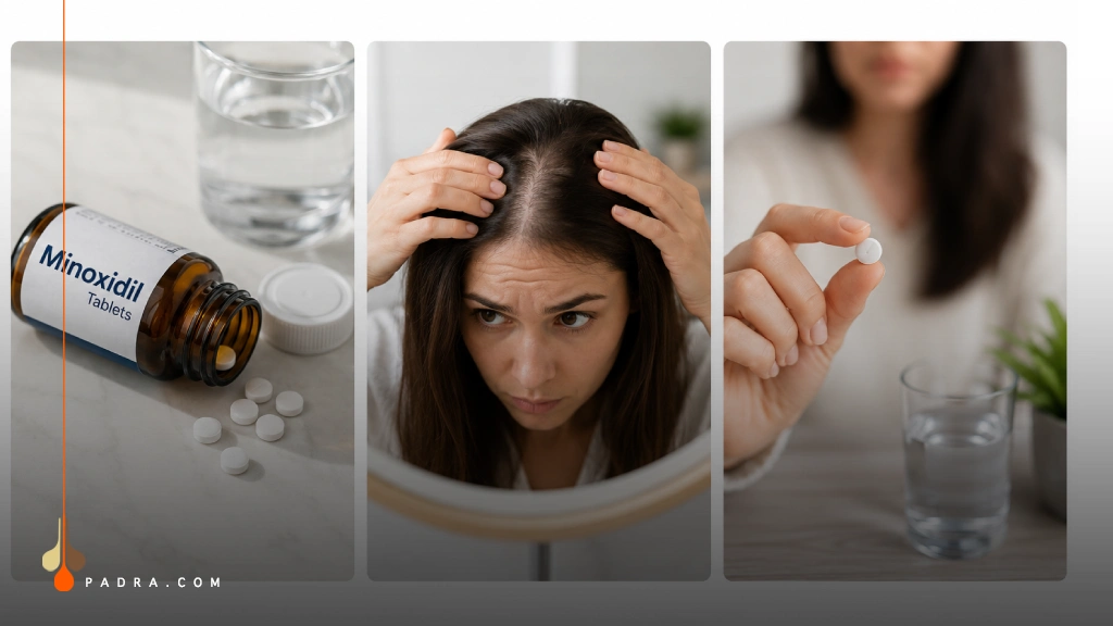 Hair Thinning and Oral Minoxidil Treatment