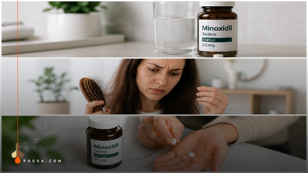 Oral Minoxidil Tablets for Hair Loss