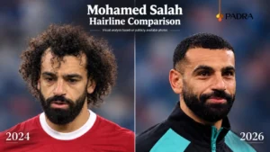 mohamed-salah-hairline-before-after-2026